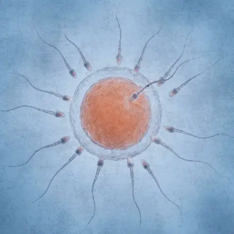 FIV-Fecundación In Vitro