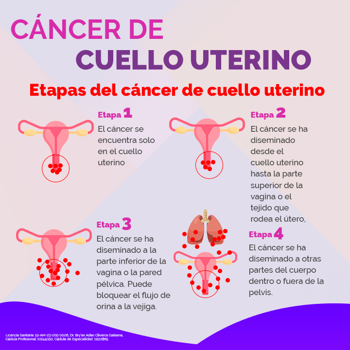 Qué Es Cáncer Grado 2